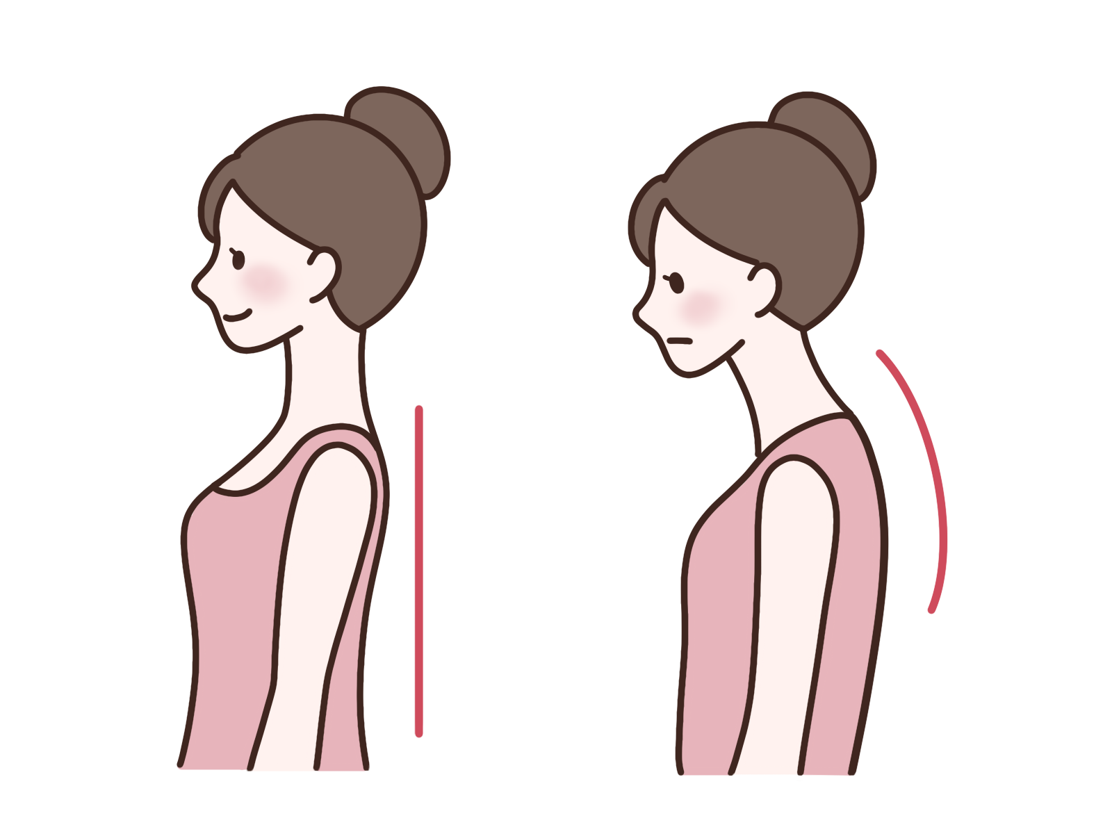 正しい姿勢とストレートネックの女性のイラスト